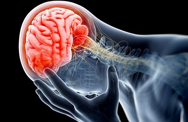 traumatic brain injury treatment