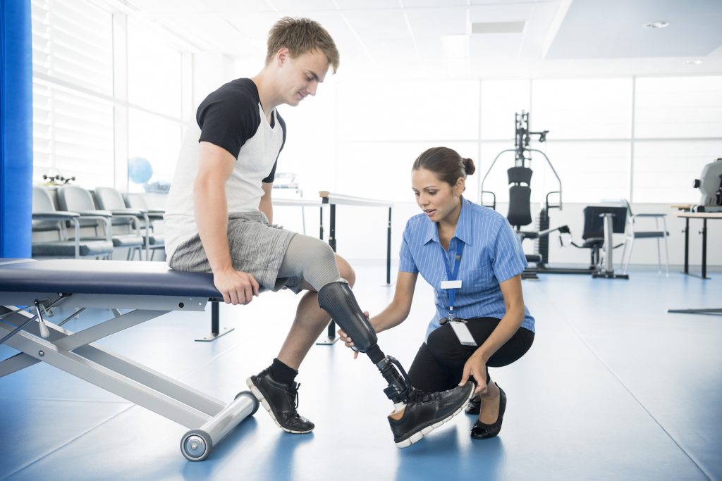 Rehabilitation is key for successful use of post-amputation prosthetics